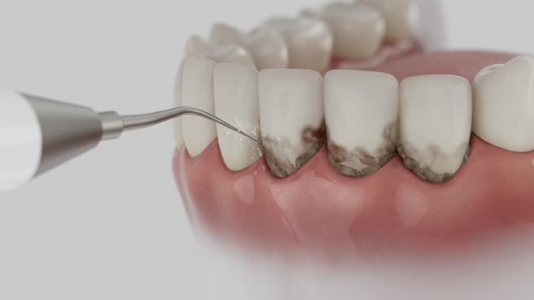 Trusted Teeth Cleaning And Checkup service in South Sumter, SC - Dentist Open Now